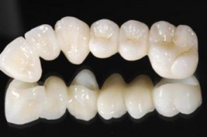 Безметалловая технология в стоматологии