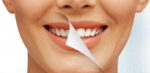 Что нужно знать про отбеливание зубов?