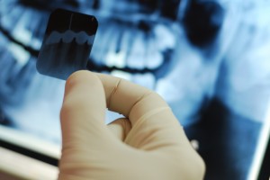 Диагностика зубов и ротовой полости