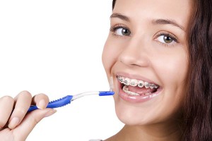 Чистка зубов при наличии брекетов