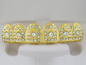 Какие бывают коронки?
