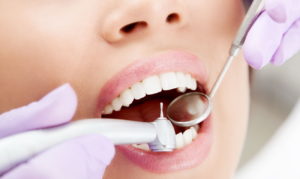 Лечение каналов зубов по правилам