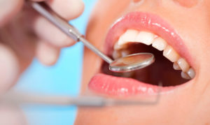 Шинирование зубов, необходимость проведения процедуры