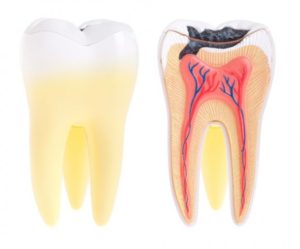 Болит зубы после пломбирования - причины