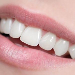 Профилактика эрозии зубов